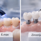 E-max ili Zirconija? Savremeni materijali u estetskoj protetici