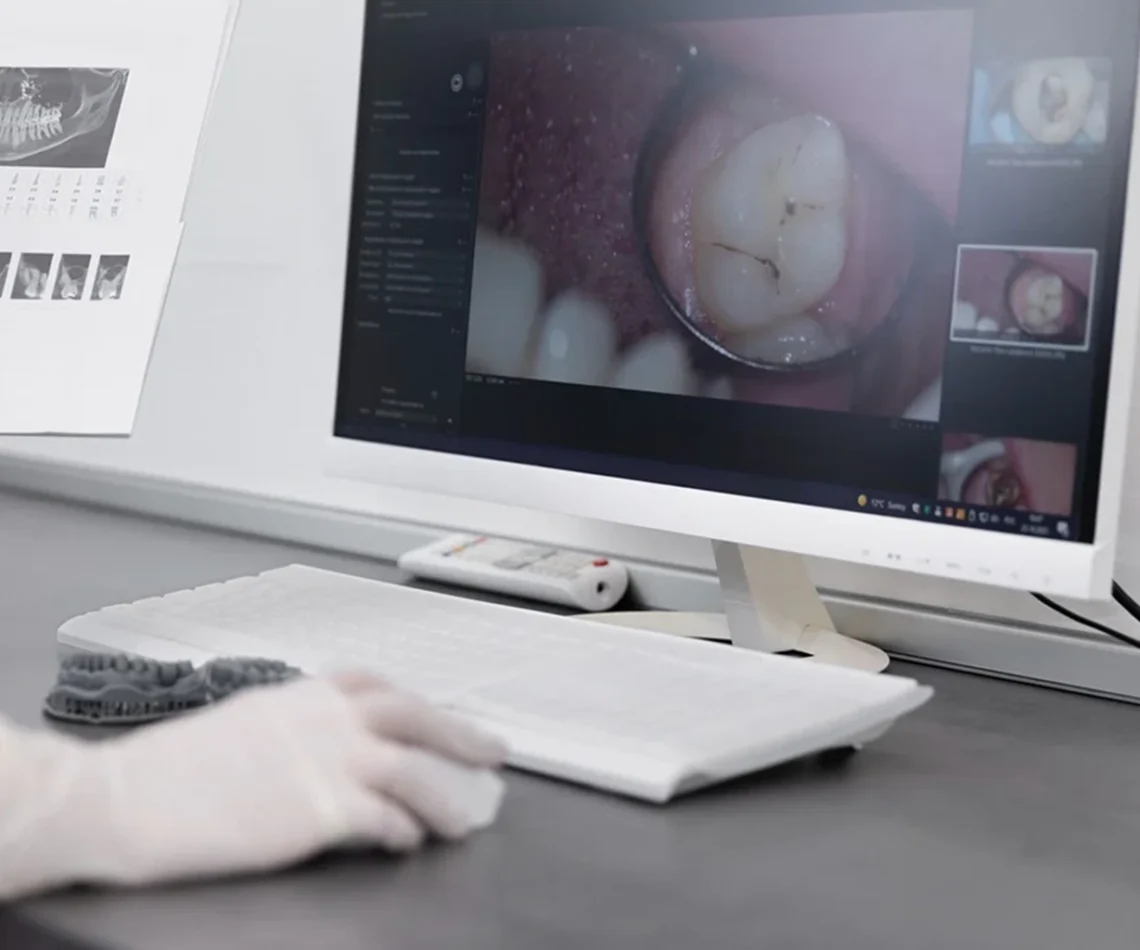 Digitalna-stomatologija-2026-Kako-CAD-CAM-menja-standarde-u-protetici-1200×721-111