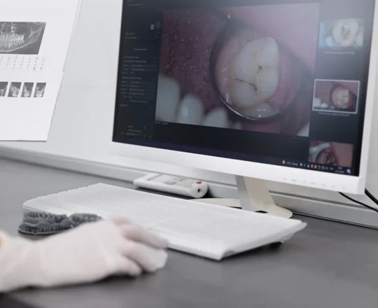 Digitalna-stomatologija-2026-Kako-CAD-CAM-menja-standarde-u-protetici-1200×721-111