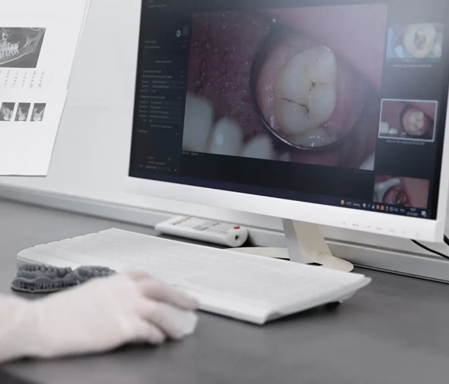 Digitalna-stomatologija-2026-Kako-CAD-CAM-menja-standarde-u-protetici-1200×721-111