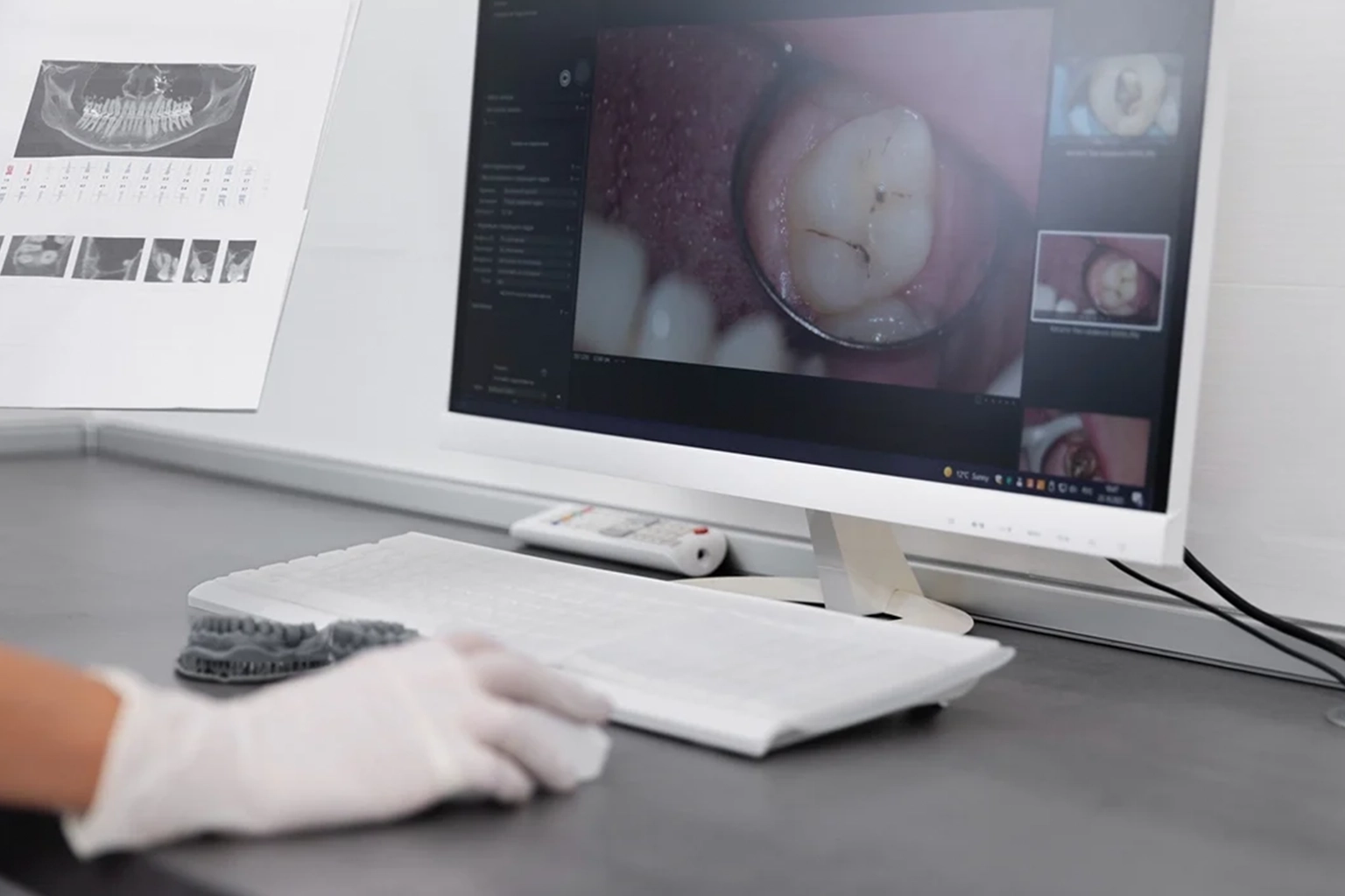 Digitalna-stomatologija-2026-Kako-CAD-CAM-menja-standarde-u-protetici-1200×721-111
