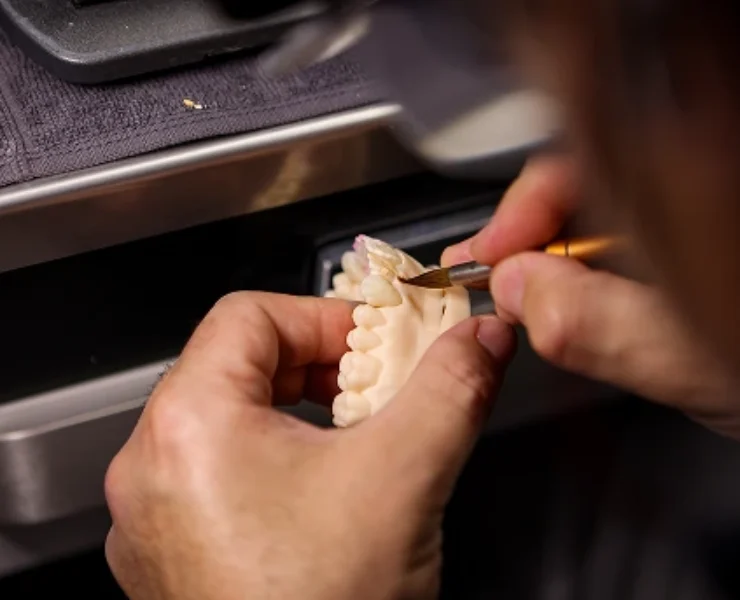 Two-day 4 Anterior Veneers LIVE COURSE