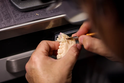 Two-day 4 Anterior Veneers LIVE COURSE